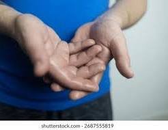 Why Do Hands Sweat Easily? Scientific Reasons, Spiritual Beliefs